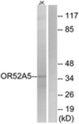 Western blot of extracts from Jurkat cells, using OR52A5 Antibody. The lane on the right is treated with the synthesized peptide.