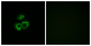 Immunofluorescence of MCF7 cells, using OR52D1 Antibody. The picture on the right is treated with the synthesized peptide.