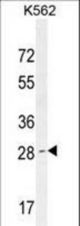 OR52D1 Antibody western blot of K562 cell line lysates (35 ug/lane). The OR52D1 antibody detected the OR52D1 protein (arrow).