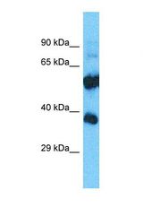Western blot of Human Placenta. OR52E2 antibody dilution 1.0 ug/ml.