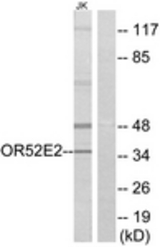 Western blot of extracts from Jurkat cells, using OR52E2 Antibody. The lane on the right is treated with the synthesized peptide.