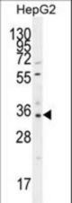 OR52I2 Antibody western blot of HepG2 cell line lysates (35 ug/lane). The OR52I2 antibody detected the OR52I2 protein (arrow).