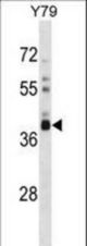 OR52L1 Antibody western blot of Y79 cell line lysates (35 ug/lane). The OR52L1 antibody detected the OR52L1 protein (arrow).
