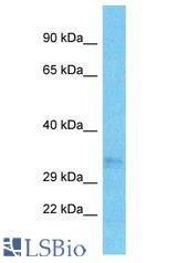 OR52N5 antibody Western Blot of ACHN. Antibody dilution: 1 ug/ml.