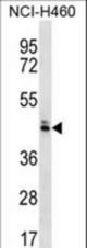 OR52N5 Antibody western blot of NCI-H460 cell line lysates (35 ug/lane). The OR52N5 antibody detected the OR52N5 protein (arrow).