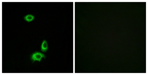 Immunofluorescence of HUVEC cells, using OR56B1 Antibody. The picture on the right is treated with the synthesized peptide.