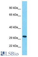 OR56B1 antibody Western Blot of ACHN. Antibody dilution: 1 ug/ml.