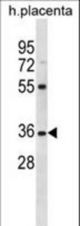 OR5AN1 Antibody western blot of human placenta tissue lysates (35 ug/lane). The OR5AN1 antibody detected the OR5AN1 protein (arrow).