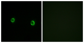 Immunofluorescence of LOVO cells, using OR5AS1 Antibody. The picture on the right is treated with the synthesized peptide.