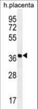 OR5AS1 Antibody western blot of human placenta tissue lysates (35 ug/lane). The OR5AS1 antibody detected the OR5AS1 protein (arrow).