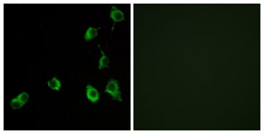 Immunofluorescence of COS7 cells, using OR5B12 Antibody. The picture on the right is treated with the synthesized peptide.