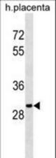 OR5B12 Antibody western blot of human placenta tissue lysates (35 ug/lane). The OR5B12 antibody detected the OR5B12 protein (arrow).