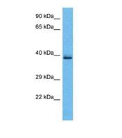Western blot of Human Jurkat. OR5H2 antibody dilution 1.0 ug/ml.