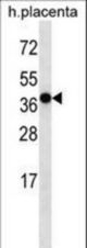 OR5H2 Antibody western blot of human placenta tissue lysates (35 ug/lane). The OR5H2 antibody detected the OR5H2 protein (arrow).