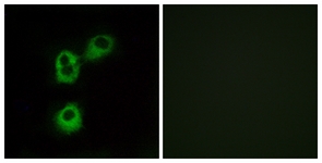 Immunofluorescence of MCF7 cells, using OR5M1 Antibody. The sample on the right was incubated with synthetic peptide.