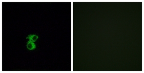 Immunofluorescence of MCF7 cells, using OR6B2 Antibody. The picture on the right is treated with the synthesized peptide.