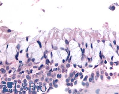 Anti-OR6K3 antibody LS-A4355 IHC of human nasal mucosa, respiratory epithelium. Immunohistochemistry of formalin-fixed, paraffin-embedded tissue after heat-induced antigen retrieval.