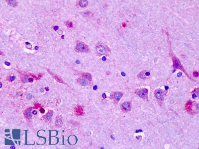 Anti-OR6N1 antibody IHC of human brain, cortex, neurons. Immunohistochemistry of formalin-fixed, paraffin-embedded tissue after heat-induced antigen retrieval. Antibody LS-A3228 concentration 6-14 ug/ml.