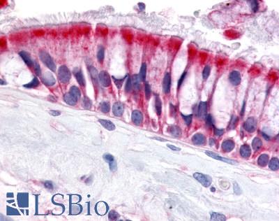 Anti-OR6N1 antibody LS-A3227 IHC of human nasal mucosa, respiratory epithelium. Immunohistochemistry of formalin-fixed, paraffin-embedded tissue after heat-induced antigen retrieval.