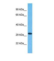 Western blot of Human Jurkat. OR6N2 antibody dilution 1.0 ug/ml.