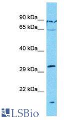 OR7G1 antibody Western Blot of HT1080. Antibody dilution: 1 ug/ml.