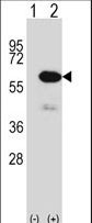 Western blot of METAP2 (arrow) using rabbit polyclonal METAP2 Antibody. 293 cell lysates (2 ug/lane) either nontransfected (Lane 1) or transiently transfected (Lane 2) with the METAP2 gene.