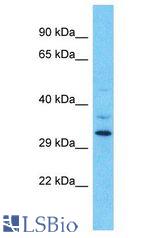 OR9Q1 antibody Western Blot of HT1080. Antibody dilution: 1 ug/ml.