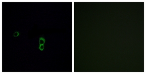 Immunofluorescence of MCF7 cells, using OR9Q1 Antibody. The picture on the right is treated with the synthesized peptide.