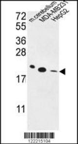 ORAI2 Antibody (C-term) Western blot of MDA-MB231,HepG2 cell line and mouse cerebellum tissue lysates (35 ug/lane). This demonstrates the ORAI2 antibody detected the ORAI2 protein (arrow).