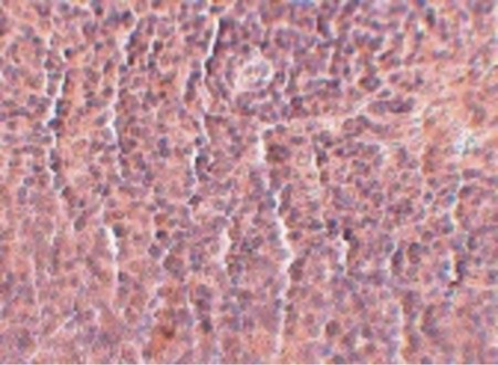 Immunohistochemistry of ORAI3 in rat spleen tissue with ORAI3 antibody at 2.5 ug/ml.