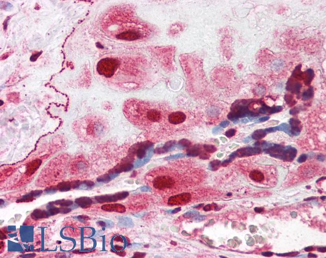 Anti-ORAI3 antibody IHC of human placenta. Immunohistochemistry of formalin-fixed, paraffin-embedded tissue after heat-induced antigen retrieval. Antibody LS-B2718 concentration 3 ug/ml.
