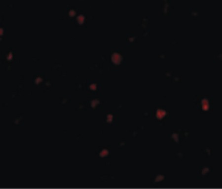 Immunofluorescence of ORAI3 in A20 cells with ORAI3 antibody at 10 ug/ml.