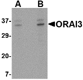 Western blot of ORAI3 in A20 cell lysate with ORAI3 antibody at (A) 2 and (B) 4 ug/ml.