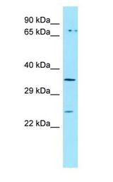ORAI3 antibody Western Blot of MCF7.