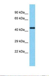 Western blot of Human HCT15. METTL17 antibody dilution 1.0 ug/ml.
