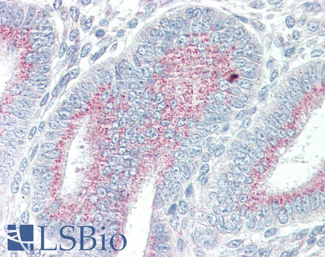 Anti-ORAI3 antibody IHC of human uterus. Immunohistochemistry of formalin-fixed, paraffin-embedded tissue after heat-induced antigen retrieval. Antibody LS-B2385 concentration 5 ug/ml.
