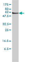 ORC2L monoclonal antibody (M01), clone 3E11-1G5 Western blot of ORC2L expression in Jurkat.