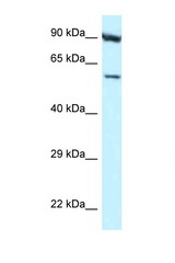 ORC3 / ORC3L antibody LS-C145742 Western blot of HepG2 Cell lysate. Antibody concentration 1 ug/ml.