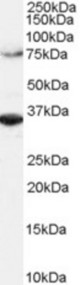 Antibody (2 ug/ml) staining of HeLa lysate (RIPA buffer, 1.4E5 cells per lane). Detected by Western blot of chemiluminescence.