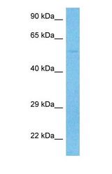 Western blot of ORC4 Antibody with human HeLa Whole Cell lysate.