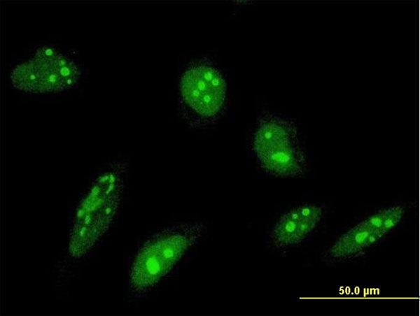 Immunofluorescence of monoclonal antibody to ORC4L on HeLa cell . [antibody concentration 10 ug/ml]