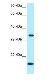 ORC5 antibody Western Blot of Fetal Heart.