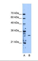 Lane A: Marker. Lane B: HepG2 cell lysate. Antibody concentration: 2.5 ug/ml. Gel concentration: 12%.