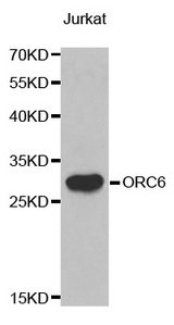 Western blot analysis of extracts of Jurkat cell line, using ORC6 antibody.