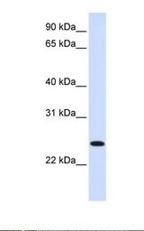 Fetal liver lysate. Antibody concentration: 1.0 ug/ml. Gel concentration: 12%.