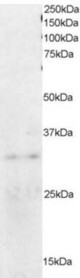 Antibody staining (0.2 ug/ml) of HeLa lysate (RIPA buffer, 35 ug total protein per lane). Primary incubated for 1 hour. Detected by Western blot of chemiluminescence.