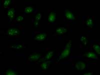 Immunostaining analysis in HeLa cells. HeLa cells were fixed with 4% paraformaldehyde and permeabilized with 0.1% Triton X-100 in PBS. The cells were immunostained with anti-ORC6L mAb.