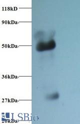Western blot of alpha 1-acid glycoprotein antibody at 2 ug/ml + Human serum at 1:50. Secondary: Goat polyclonal to Rabbit IgG at 1:10000 dilution.
