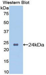 Western blot of recombinant ORM1 / Orosomucoid.