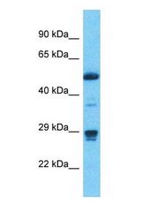 Western blot of METTL1 Antibody with Stomach Tumor lysate.